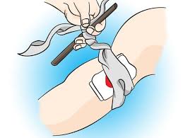 Como Fazer Um Torniquete? Passo a Passo Para Fazer
